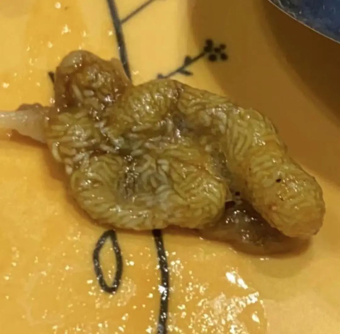 好欢螺螺蛳粉吃出虫卵?当地监管部门已介入调查